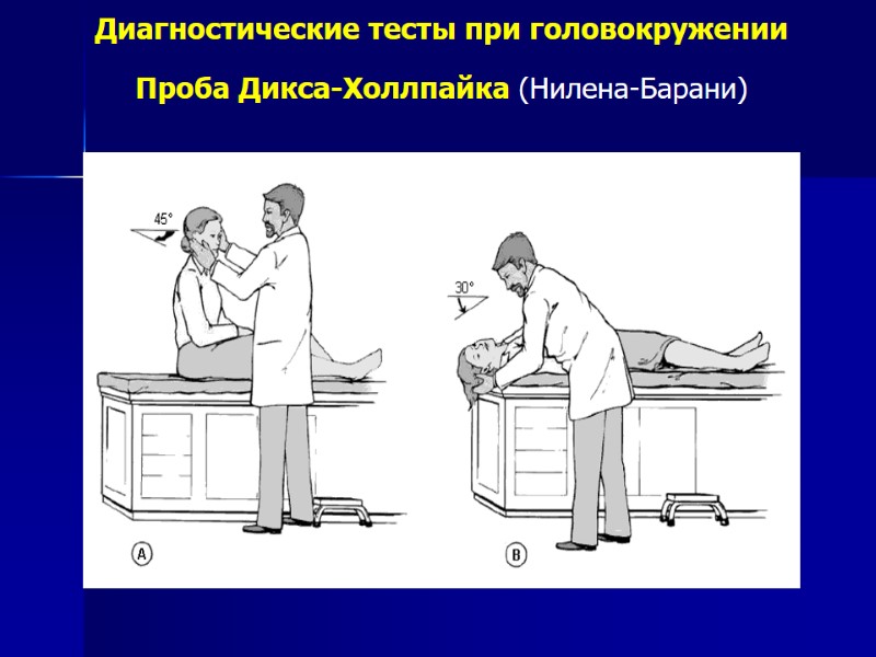 Диагностические тесты при головокружении Проба Дикса-Холлпайка (Нилена-Барани)